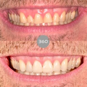 blog - 360 Dental