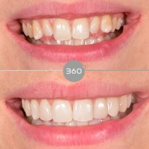 blog - 360 Dental