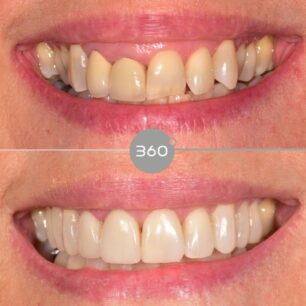 blog - 360 Dental