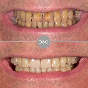 blog - 360 Dental