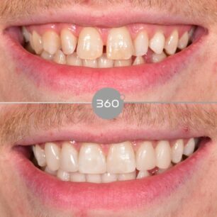 blog - 360 Dental