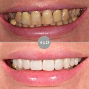 blog - 360 Dental