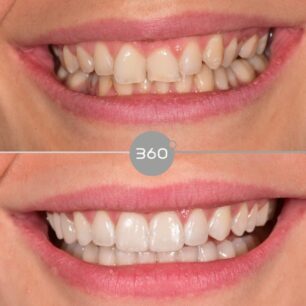 blog - 360 Dental