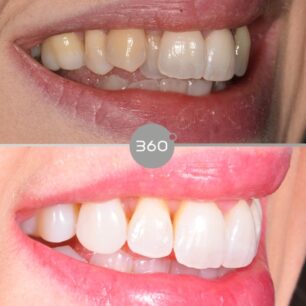 blog - 360 Dental