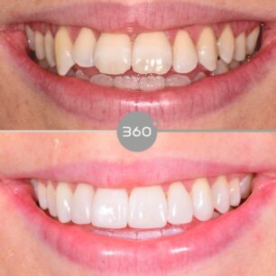 blog - 360 Dental