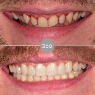 blog - 360 Dental