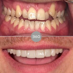 blog - 360 Dental