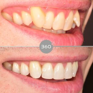 blog - 360 Dental