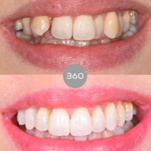 blog - 360 Dental