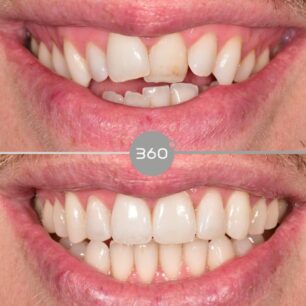 blog - 360 Dental