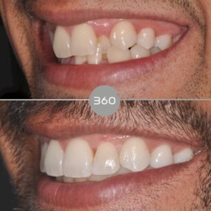 blog - 360 Dental