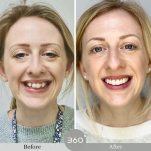 blog - 360 Dental