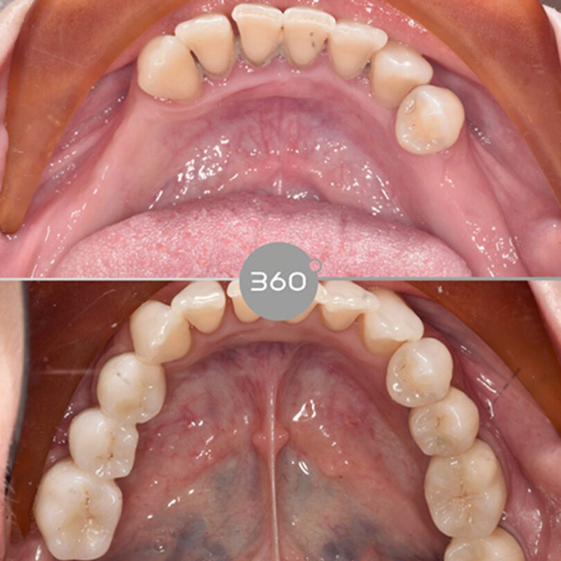 360 Dental